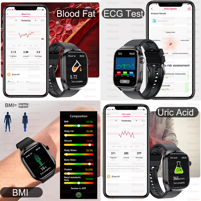 2025 Nuovo Smart Watch ad alta - Smartwatch New Watches 2025 recensione e prezzo